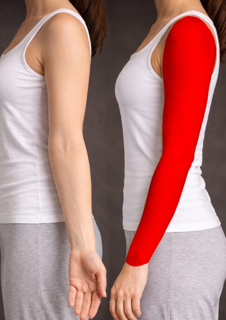 Arm — sleeve, front side only