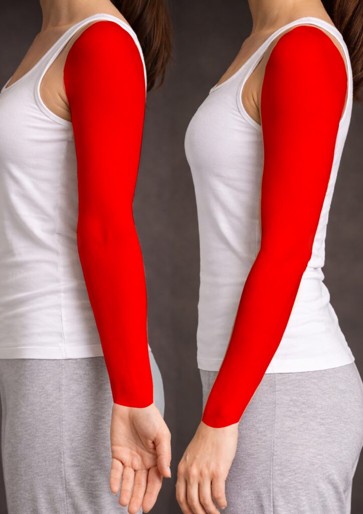 Arm — full sleeve, circle